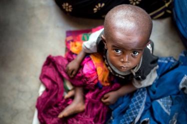 Le 19 mai 2017, un enfant souffrant de malnutrition attend des s