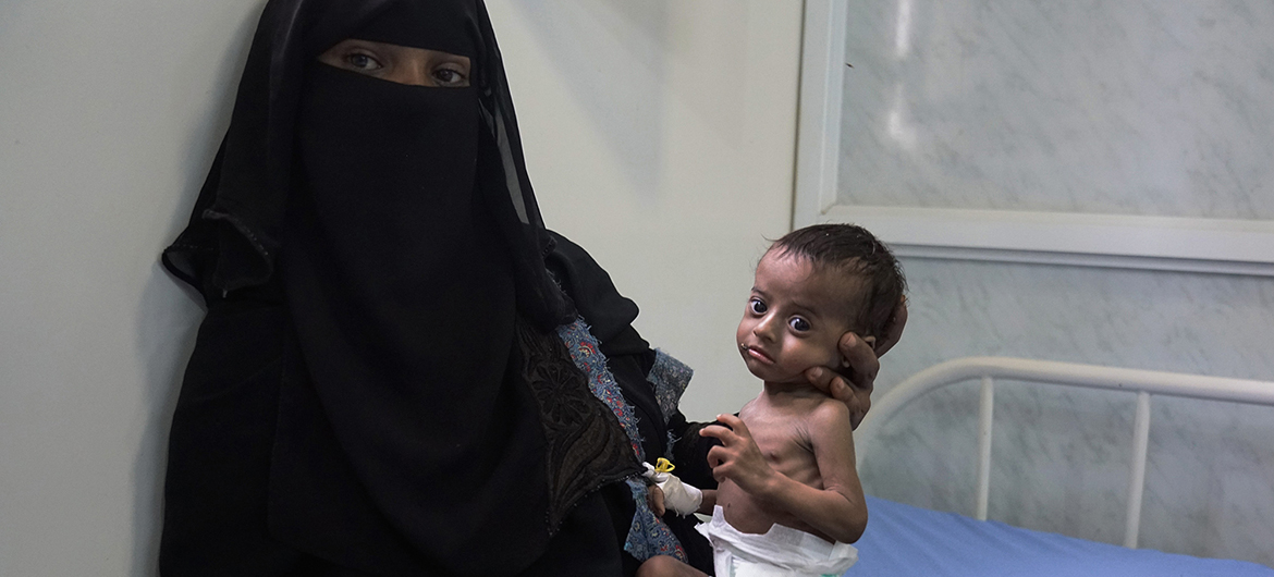 Four months-old Saleh, admitted in Al Hudaydah’s main hospital in April 2017, and his mother Nora. Close to half a million children and two million mothers in Yemen are at risk of dying from severe acute malnutrition due to ongoing conflict.